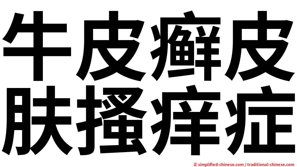 牛皮癣皮肤搔痒症