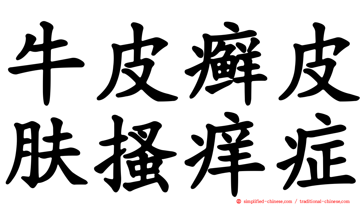 牛皮癣皮肤搔痒症