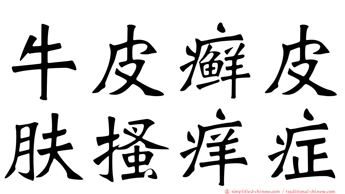 牛皮癣皮肤搔痒症