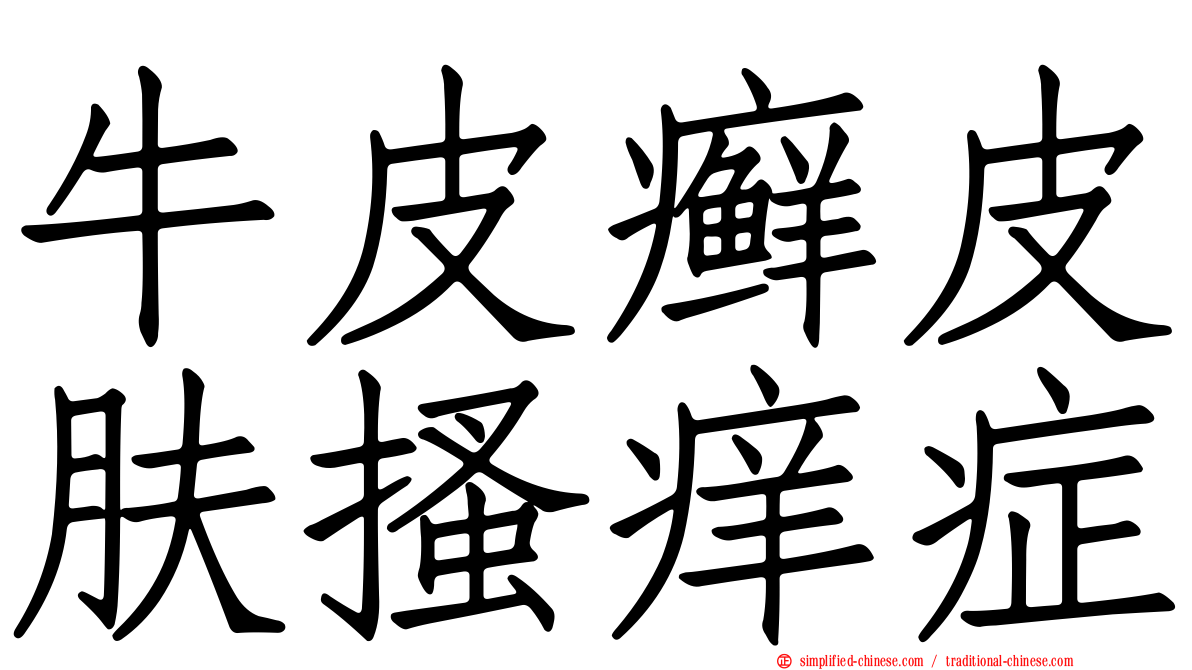 牛皮癣皮肤搔痒症
