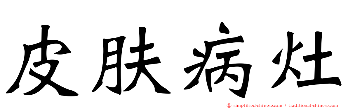 皮肤病灶