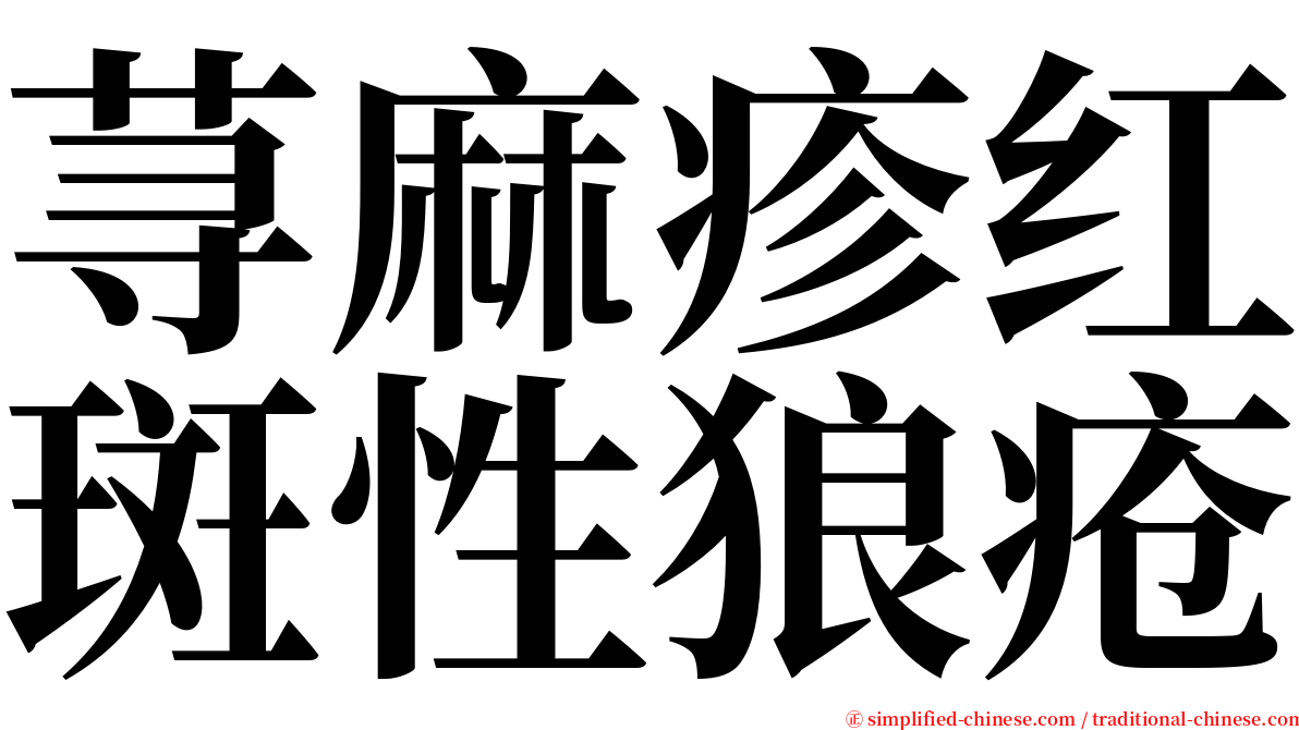 荨麻疹红斑性狼疮 serif font